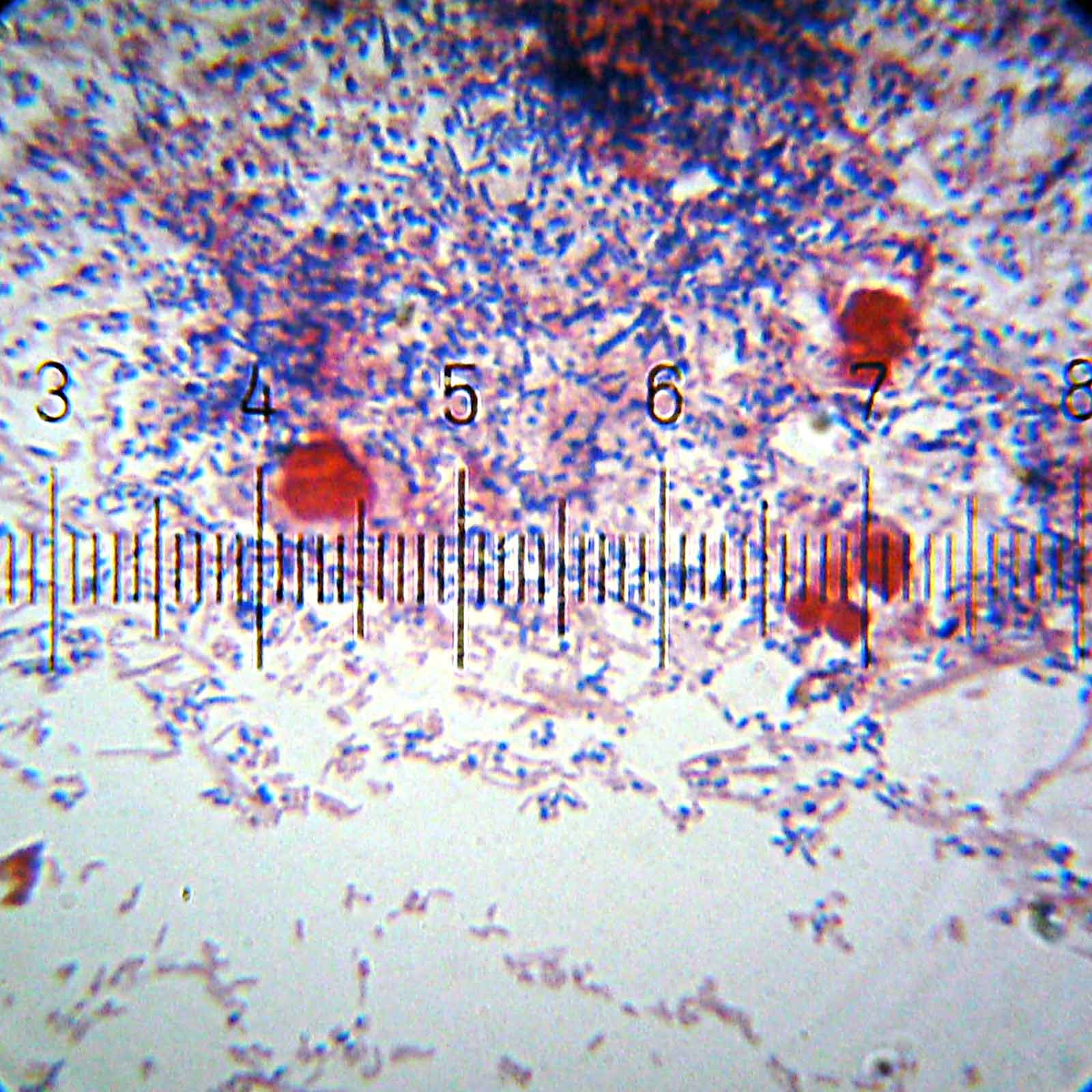 Bacteria scraped from teeth, seen through a microscope: thousands of tiny stained rods and dots.
